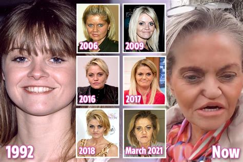 danniella westbrook 1999|danniella westbrook face collapse.